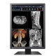 Ecran Eizo RadiForce RX250