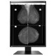 Ecran Eizo RadiForce GX560-MD