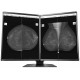 Ecran Eizo RadiForce GX560-MD