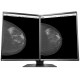 Ecran Eizo RadiForce GX560-MD