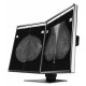 Ecran Eizo RadiForce GX560-MD