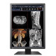  Ecran EIZO RadiForce RX250