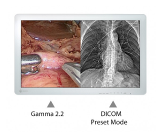 ajustement indépendant des affichages écran bloc opératoire eizo curator ex2620
