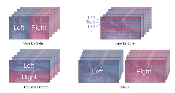 compatibilité différents signaux 3D écran bloc opératoire eizo curator ex2620