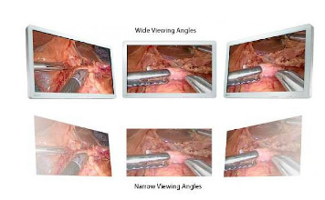 grand angle de vision écran bloc opératoire eizo curator ex2620