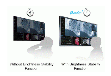 stabilisation rapide des images écran bloc opératoire eizo curator ex271w