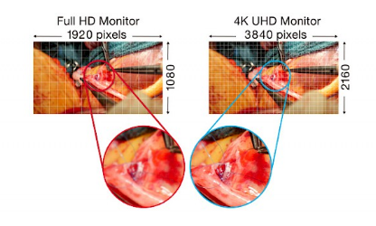 résolution 4K écran bloc opératoire eizo curator ex3140