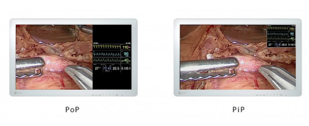 segmentation de l'affichage écran bloc opératoire eizo curator ex3220