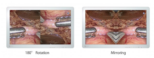 rotation affichage et fonction miroir écran bloc opératoire eizo curator ex3220