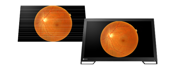 technologie anti-scintillement écran médical tactile eizo radiforce ms236wt