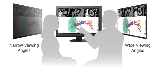 grand angle de vision écran médical EIZO Radiforce MX242W