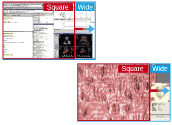 plus d'information avec un format 16:10 écran médical EIZO Radiforce MX242