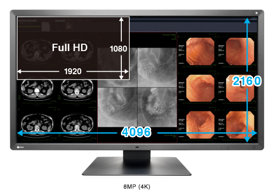 haute résolution 8MP écran médical EIZO Radiforce MX315W