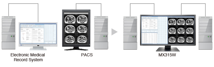 amélioration de la lisibilité des images écran médical EIZO Radiforce MX315W