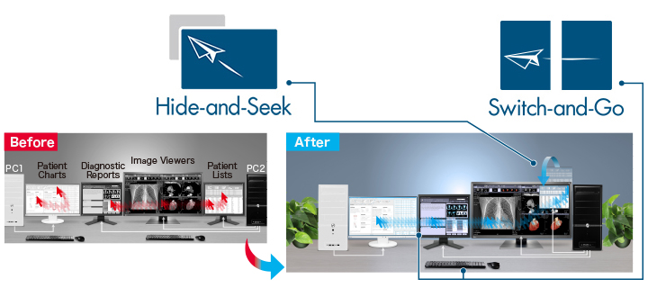 fonction amélioration flux d'informations écran médical EIZO MX315W