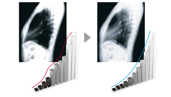 maintien du diagnostic écran médical EIZO Radiforce MX315W