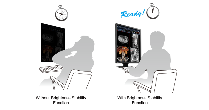 stabilisation rapide de la luminosité écran médical EIZO Radiforce RX250