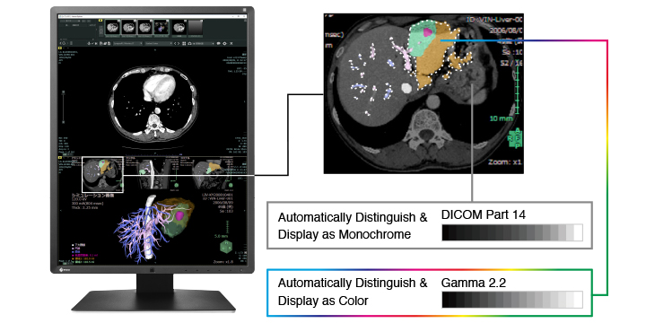 Affichage monochrome et couleurs radiologie écran médical Radiforce EIZO RX250