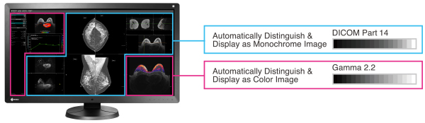 optimisation de la luminosité et du contraste écran médical EIZO Radiforce RX850