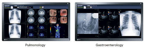 Rationalisation des images écran médical EIZO Radiforce RX850