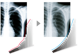 maintient de la luminosité écran médicale EIZO Radiforce RX660