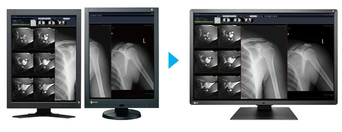 monodalle écran médical EIZO Radiforce RX660